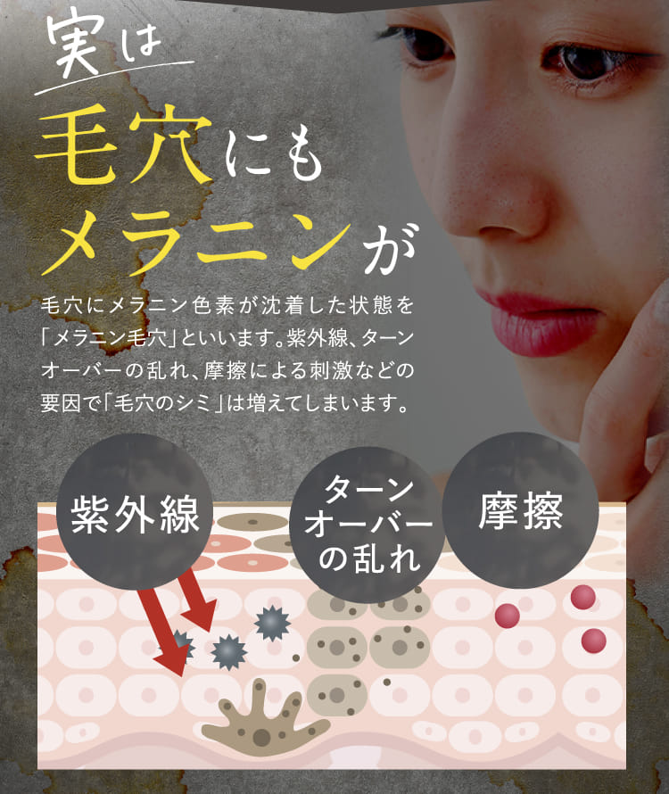 毛穴にもメラニンが