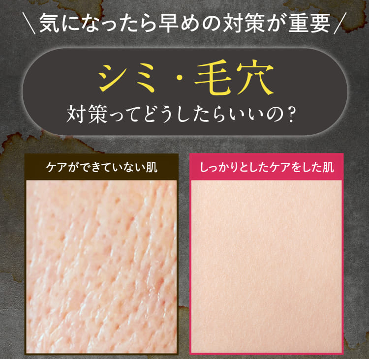 シミ・毛穴対策ってどうしたらいいの？