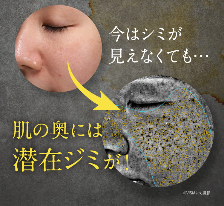 肌の奥には潜在ジミが！