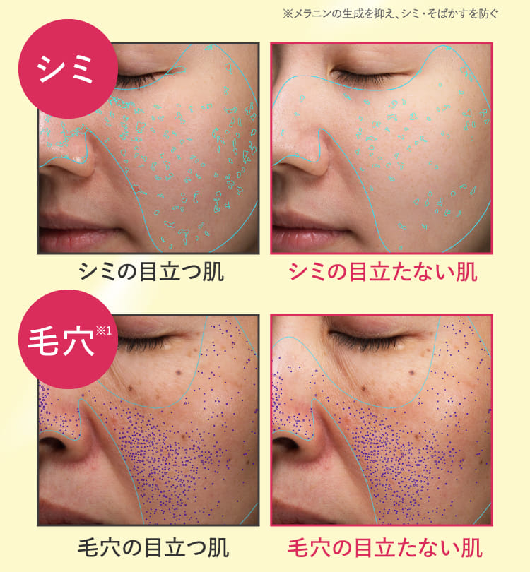 シミ 毛穴