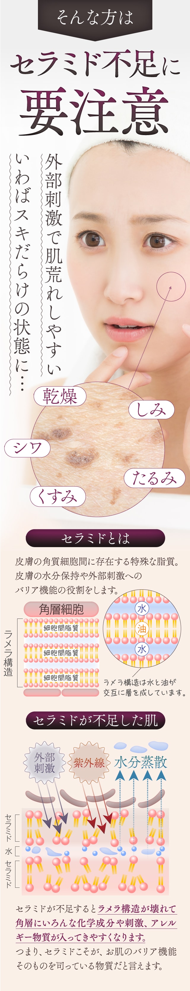 セラミド不足に要注意